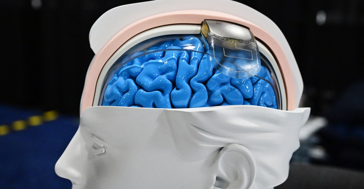 Revolusi Teknologi Otak ada di sini – dan tidak semua cermin hitam